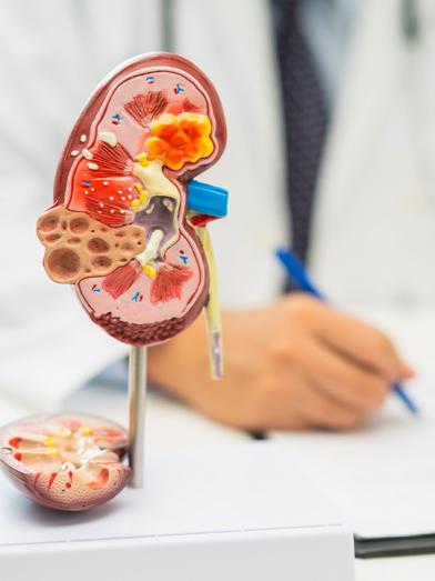 Three dimensional color model of a kidney